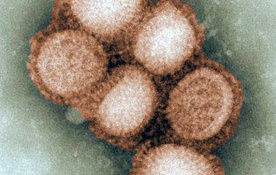 インフルエンザウイルス電子顕微鏡写真